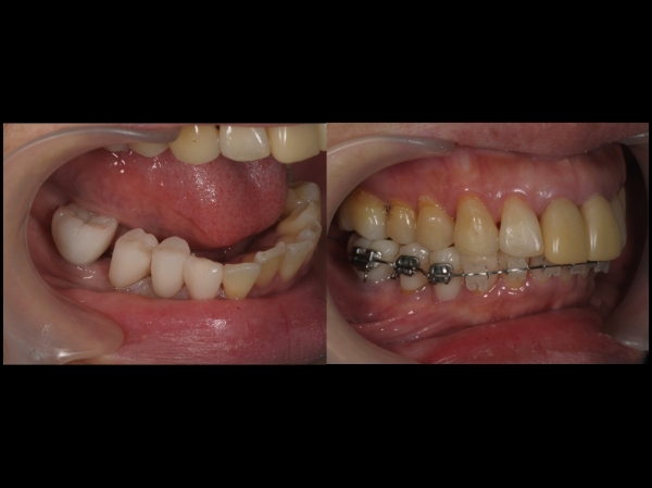矯正歯科と一般歯科の連携